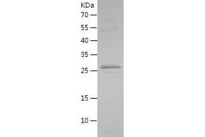 Western Blotting (WB) image for FXYD Domain Containing Ion Transport Regulator 3 (FXYD3) (AA 21-87) protein (His-IF2DI Tag) (ABIN7123021)