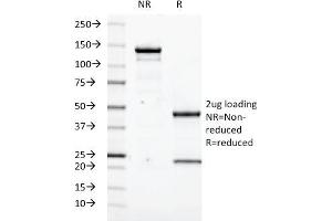SDS-PAGE Analysis Purified Transglutaminase II Mouse Monoclonal Antibody (SPM358).