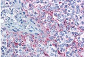 Human Tonsil (formalin-fixed, paraffin-embedded) stained with MTBP antibody ABIN213954 at 10 ug/ml followed by biotinylated goat anti-rabbit IgG secondary antibody ABIN481713, alkaline phosphatase-streptavidin and chromogen. (MTBP anticorps  (AA 122-139))