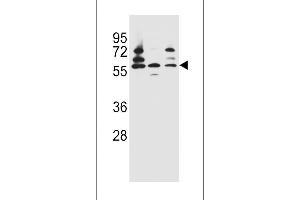 PDP1 Antibody (Center) (ABIN656386 and ABIN2845681) western blot analysis in Jurkat,HepG2,293 cell line lysates (35 μg/lane). (PDP anticorps  (AA 308-336))