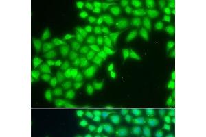 Immunofluorescence analysis of MCF-7 cells using METTL2A Polyclonal Antibody (METTL2A anticorps)