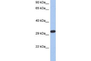 WB Suggested Anti-CAPZA3 Antibody Titration: 0. (CAPZA3 anticorps  (N-Term))