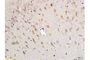Formalin-fixed and paraffin embedded: rat brain tissue labeled with Anti-NK-2R Polyclonal Antibody , Unconjugated at 1:200 followed by conjugation to the secondary antibody and DAB staining (TACR2 anticorps  (AA 223-300))