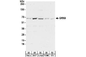 Western Blotting (WB) image for anti-G Protein-Coupled Receptor Kinase 6 (GRK6) (AA 526-576) antibody (ABIN7453097)