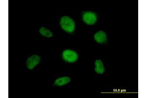 Immunofluorescence of purified MaxPab antibody to SS18 on HeLa cell.