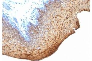 Formalin-fixed, paraffin-embedded human tonsil stained with Cytokeratin 10 + 13 antibody (DE-K13) (Keratin 10/13 anticorps)