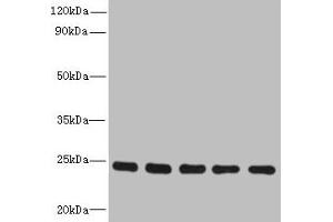 Western blot All lanes: RAB6B antibody at 5 μg/mL Lane 1: Mouse brain tissue Lane 2: U251 whole cell lysate Lane 3: MCF-7 whole cell lysate Lane 4: A549 whole cell lysate Lane 5: K562 whole cell lysate Secondary Goat polyclonal to rabbit IgG at 1/10000 dilution Predicted band size: 24, 23 kDa Observed band size: 24 kDa
