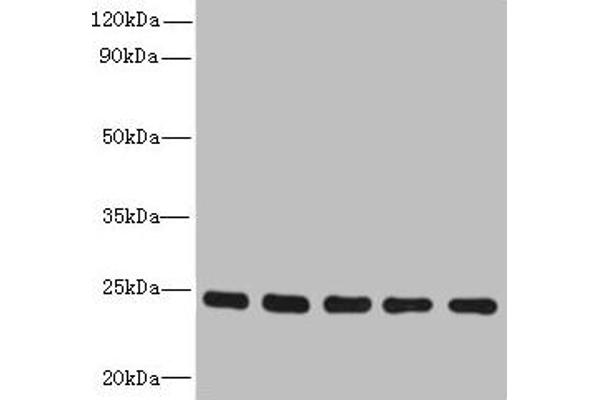RAB6B anticorps  (AA 2-208)