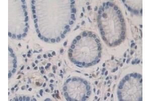 Detection of BMP15 in Human Stomach Tissue using Polyclonal Antibody to Bone Morphogenetic Protein 15 (BMP15)