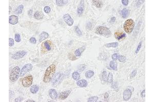 anti-Centromere Protein F (CENPF) (AA 2350-2400) antibody