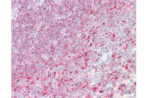 Anti-D52 / TPD52 antibody IHC staining of human spleen. (TPD52 anticorps  (AA 213-223))
