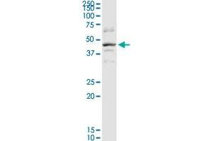 SERPINB2 MaxPab rabbit polyclonal antibody. (SERPINB2 anticorps  (AA 1-415))
