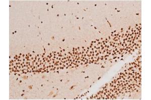 ABIN6267523 at 1/200 staining Mouse brain tissue sections by IHC-P.