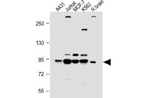 All lanes : Anti-PI3KR1 Antibody (N-term L11) at 1:2000 dilution Lane 1: A431 whole cell lysate Lane 2: Jurkat whole cell lysate Lane 3: MCF-7 whole cell lysate Lane 4: K562 whole cell lysate Lane 5: Rat brain lysate Lysates/proteins at 20 μg per lane.