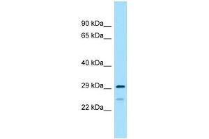 WB Suggested Anti-RPS4Y2 Antibody Titration: 1. (RPS4Y2 anticorps  (C-Term))