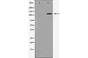Western blot analysis of nNOS expression in HeLa cells,The lane on the left is treated with the antigen-specific peptide. (NOS1 anticorps  (Internal Region))
