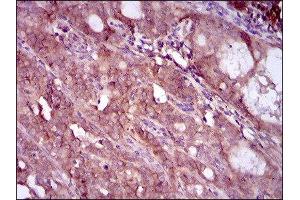 Immunohistochemistry (IHC) image for anti-EGFR Mutant (AA 693-893), (Mutant) antibody (ABIN1845729) (EGFR Mutant (AA 693-893), (Mutant) anticorps)