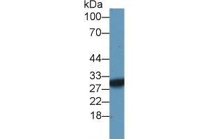 Detection of SDHB in Mouse Serum using Polyclonal Antibody to Succinate Dehydrogenase Complex Subunit B (SDHB)