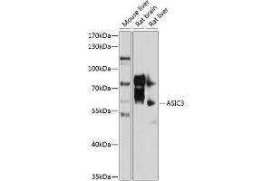 Western blot analysis of extracts of various cell lines, using  antibody (ABIN6129940, ABIN6137191, ABIN6137192 and ABIN6214455) at 1:1000 dilution. (ASIC3 anticorps  (AA 62-320))