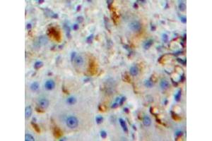 Used in DAB staining on fromalin fixed paraffin-embedded Liver tissue