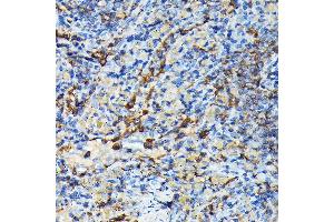 Immunohistochemistry of paraffin-embedded mouse spleen using PRC1 Rabbit pAb (ABIN6128502, ABIN6146124, ABIN6146125 and ABIN6222808) at dilution of 1:100 (40x lens). (PRC1 anticorps  (AA 351-620))