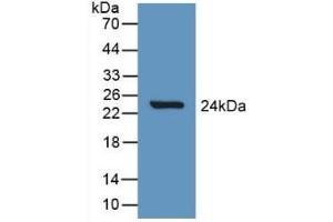 Detection of Recombinant Slit1, Rat using Polyclonal Antibody to Slit Homolog 1 (Slit1)