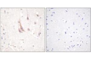 Immunohistochemistry analysis of paraffin-embedded human brain tissue, using PKC zeta (Ab-560) Antibody.