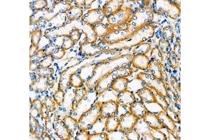 Immunohistochemistry of paraffin embedded mouse kidney using ATP1HC1 (ABIN7073160) at dilution of 1:500 (400x lens)