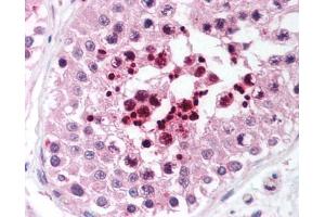 Image no. 2 for anti-Telomeric Repeat Binding Factor 2, Interacting Protein (TERF2IP) (AA 2406-2419) antibody (ABIN302914)