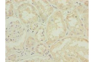 Immunohistochemistry of paraffin-embedded human kidney tissue using ABIN7150009 at dilution of 1:100 (ATPBD4 anticorps  (AA 8-267))