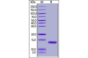 Mouse C5a, His Tag on  under reducing (R) condition.