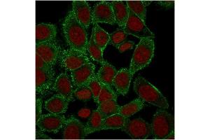Immunofluorescence Analysis of PFA-fixed HeLa cells labeling with Moesin Mouse Monoclonal Antibody (rMSN/492) followed by Goat anti-Mouse IgG-CF488 (Green).