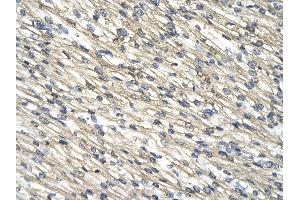 Rabbit Anti-CNP antibody   Paraffin Embedded Tissue: Human Heart cell Cellular Data: cardiac cell of renal tubule Antibody Concentration: 4.