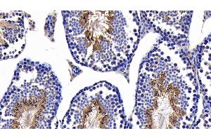 Detection of CASP8 in Mouse Testis Tissue using Polyclonal Antibody to Caspase 8 (CASP8) (Caspase 8 anticorps  (AA 219-376))
