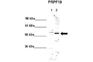 WB Suggested Anti-PRPF19 Antibody    Positive Control:  Lane 1: 5ug mouse brain cytoplasm Lane 2: 5ug mouse brain nucleus   Primary Antibody Dilution :   1:1000  Secondary Antibody :  Anti rabbit - IR-dye  Secondry Antibody Dilution :   1:10,000   Submitted by:  Anonymous (PRP19 anticorps  (Middle Region))