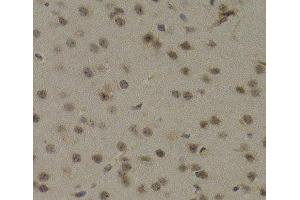 Immunohistochemistry of paraffin-embedded Mouse brain using PAWR Polyclonal Antibody at dilution of 1:200 (40x lens).
