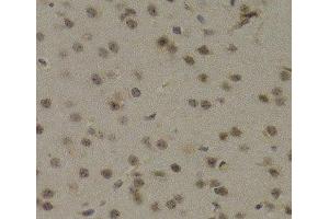 Immunohistochemistry of paraffin-embedded Mouse brain using PAWR Polyclonal Antibody at dilution of 1:200 (40x lens). (PAWR anticorps)