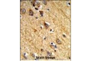 Formalin-fixed and paraffin-embedded human brain tissue reacted with JAKMIP1 Antibody (Center), which was peroxidase-conjugated to the secondary antibody, followed by DAB staining.