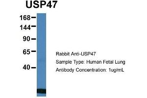 Host: Rabbit  Target Name: USP47  Sample Tissue: Human Fetal Lung  Antibody Dilution: 1. (USP47 anticorps  (Middle Region))
