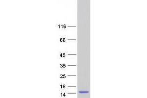 Validation with Western Blot
