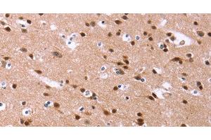 Immunohistochemistry of paraffin-embedded Human brain tissue using ID4 Polyclonal Antibody at dilution 1:40 (ID4 anticorps)
