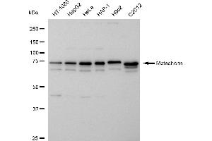 Western blotting analysis using Metadherin antibody (ABIN7799374).