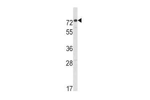 Western blot analysis of HR2 Antibody (C-term) (ABIN391175 and ABIN2841275) in CEM cell line lysates (35 μg/lane).
