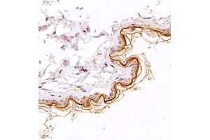 Immunohistochemistry of paraffin embedded mouse skin using TR2IT1 (ABIN7075887) at dilution of 1:1500 (400x lens) (TXNRD3NB anticorps)