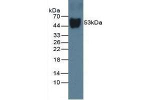 Detection of DBP in Rat Serum using Monoclonal Antibody to Vitamin D Binding Protein (DBP) (Vitamin D-Binding Protein anticorps  (AA 209-394))