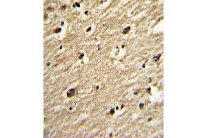 Formalin-fixed and paraffin-embedded human brain tissue reacted with the primary antibody, which was peroxidase-conjugated to the secondary antibody, followed by DAB staining.
