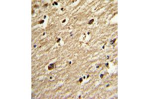 Formalin-fixed and paraffin-embedded human brain tissue reacted with the primary antibody, which was peroxidase-conjugated to the secondary antibody, followed by DAB staining.