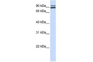PCSK6 antibody used at 0. (PCSK6 anticorps  (N-Term))