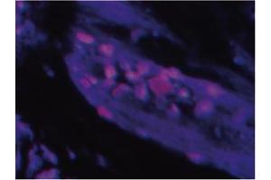 Immunofluorescence image ofTlP 39 staining in paraffn section of human trachea. (Parathyroid Hormone 2 (PTH2) anticorps)