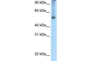 Western Blot analysis of human fetal thymus tissue lysate with EIF2A polyclonal antibody  at 2. (EIF2A anticorps  (C-Term))